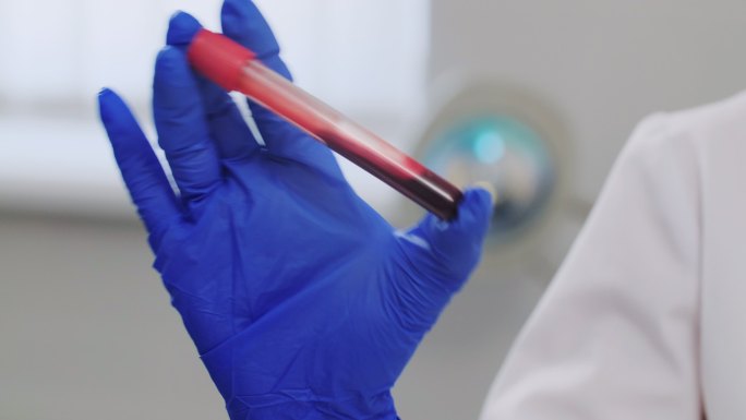 一位医生在实验室里摇动一根带有血样的试管