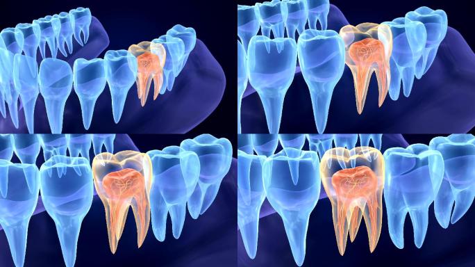牙髓学磨牙的内部结构。