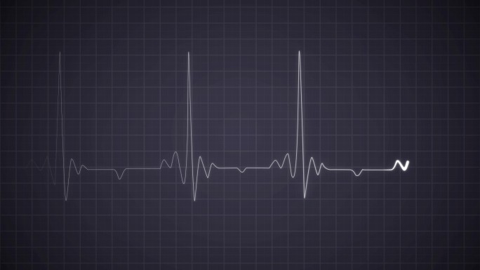 心电图心跳监护仪跳动活跃滑动健康电子监控