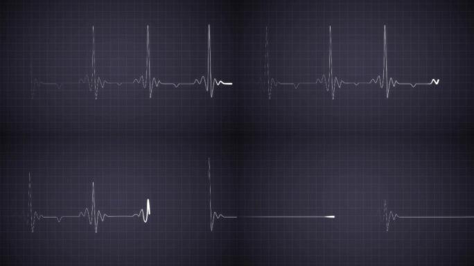 心电图心跳监护仪跳动活跃滑动健康电子监控