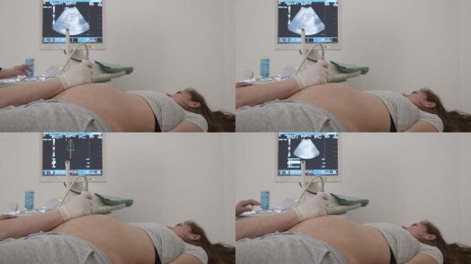 医生为孕妇使用超声波设备