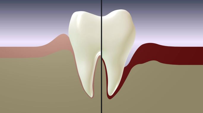 牙科护理3d动画药物概念