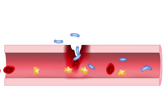细菌感染血管横截面的特写。