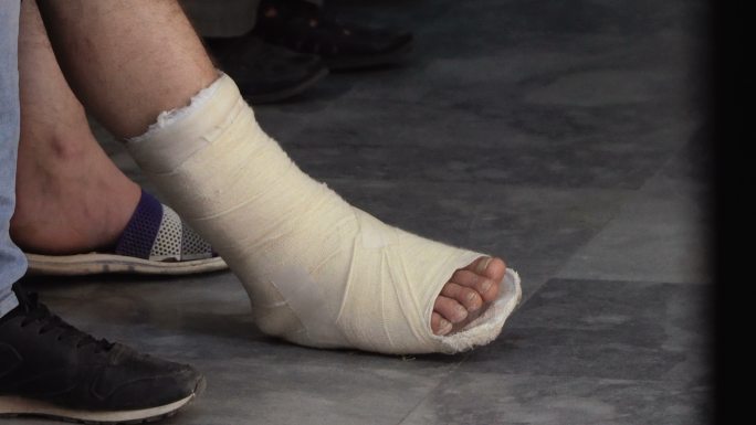 脚部受伤的人医生医学设备手术医疗门诊急救