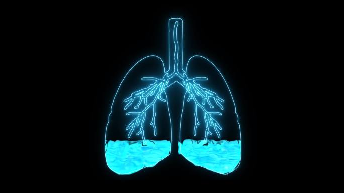 肺水肿三维医学器官3D人体