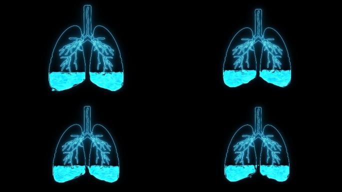 肺水肿三维医学器官3D人体