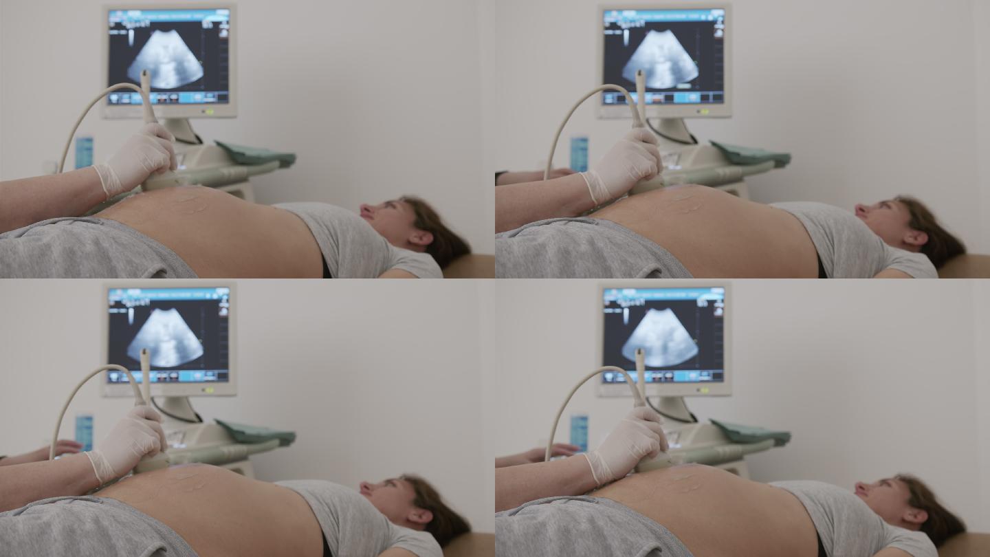 医生给孕妇做超声波，超声波检查。