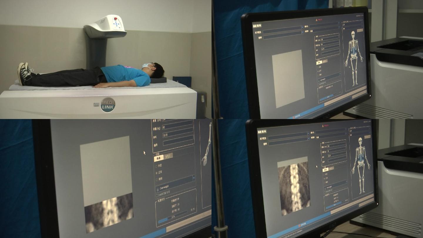 医院仪器设备检测病人扫描脊椎骨