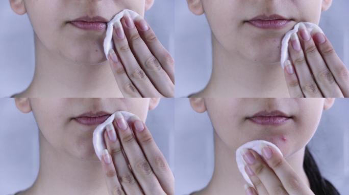 年轻女子用化妆棉将乳液涂在脸上。