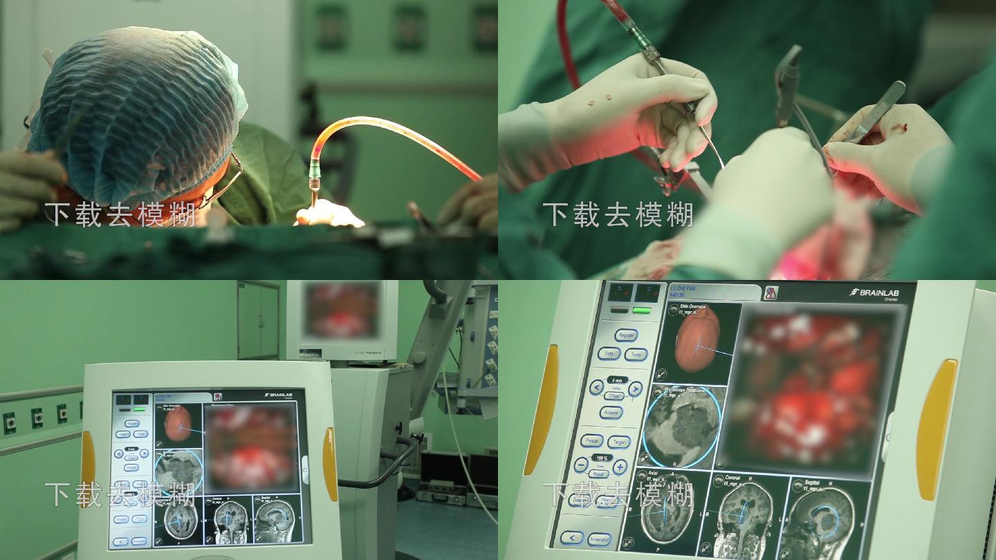 开颅手术 脑瘤 脑出血 手术设备