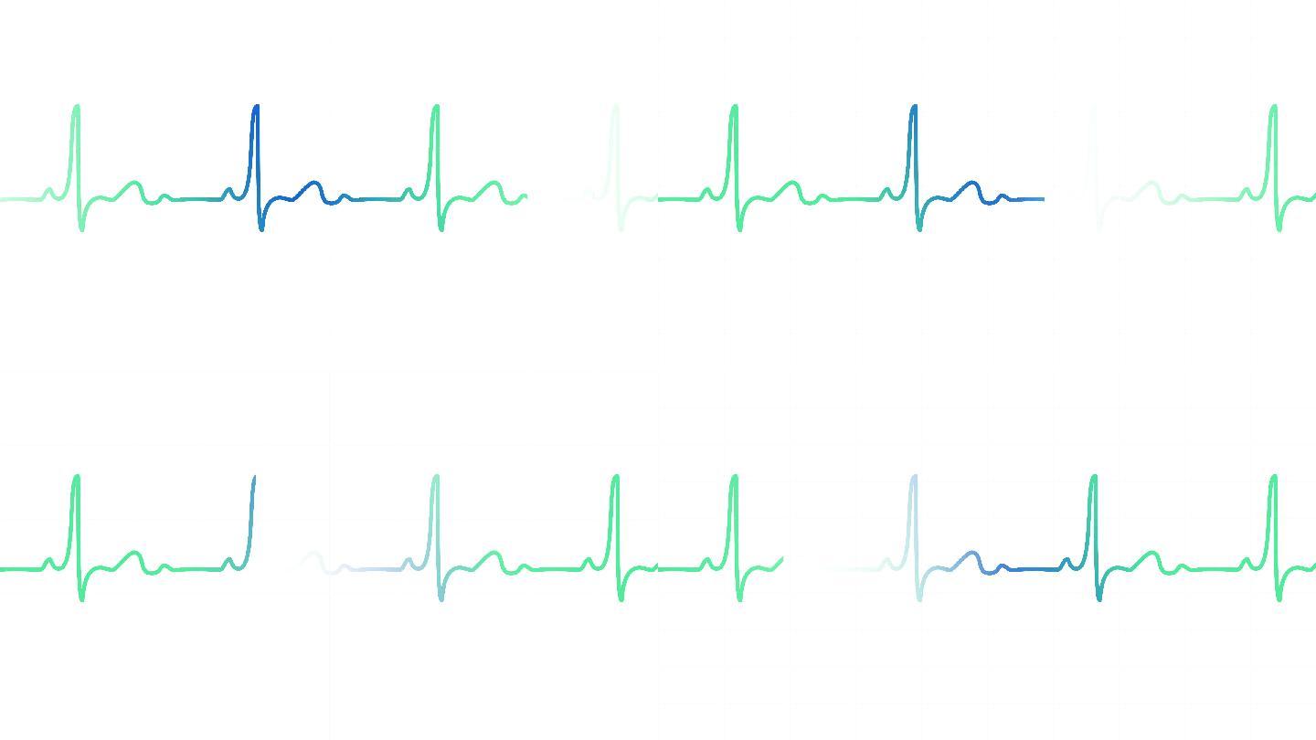 白色网格上的心电图心脏监护仪脉冲