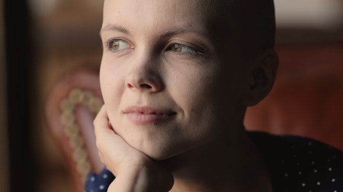 迷人的年轻女性癌症患者