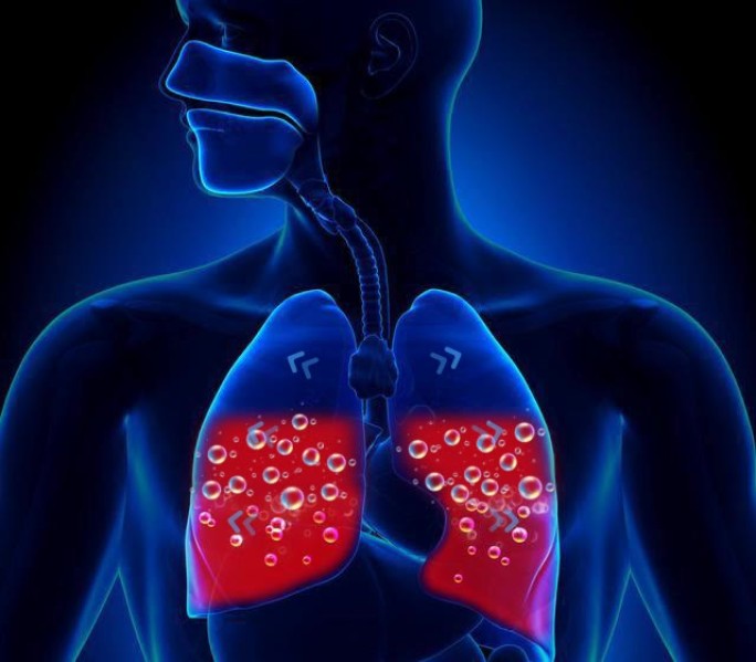 肺水肿气泡增加动画演示