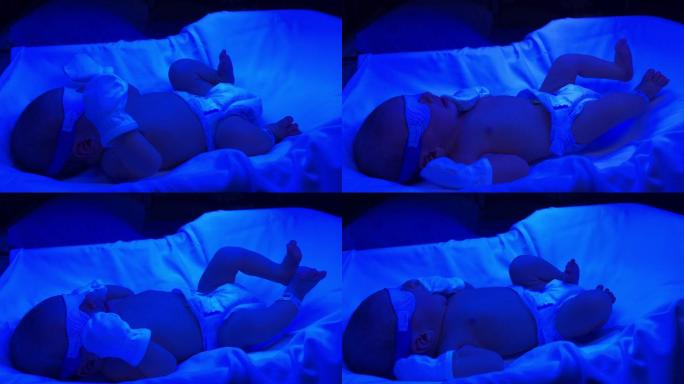 新生儿出生第一天接受光疗