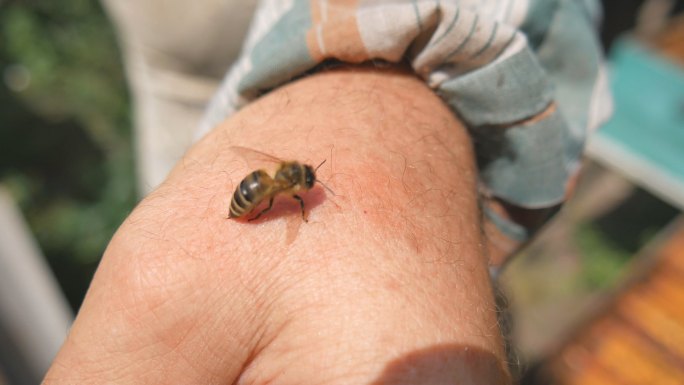 蜜蜂咬了养蜂人特写趴在手上