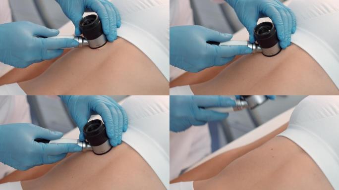 特写皮肤科医生使用皮肤镜检查患者的皮肤