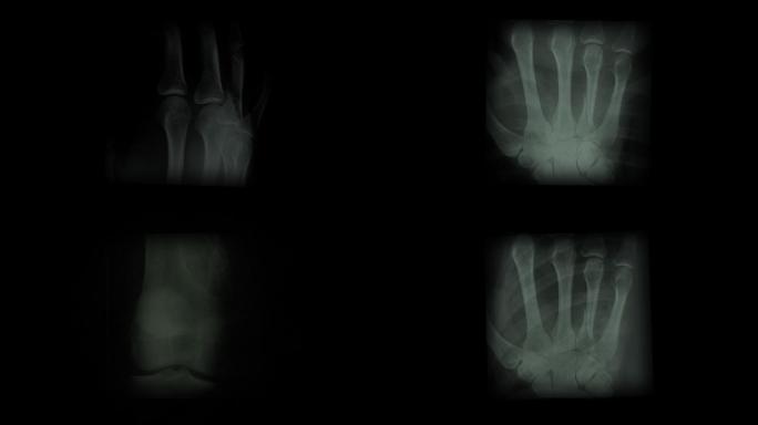 X射线图片