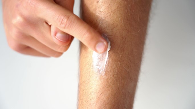 男人用去除疤痕的药膏来治愈疤痕