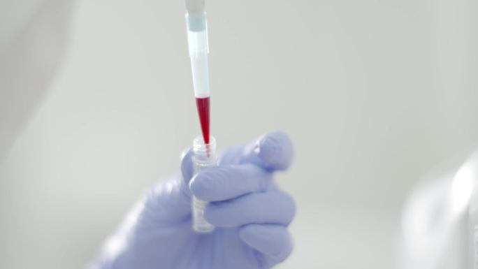 血液检验血液检测实验室试验科技样本基因