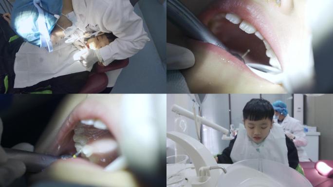 小孩儿童洗牙牙齿护理