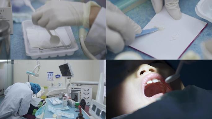 牙医治疗儿童虫牙蛀牙补牙合集