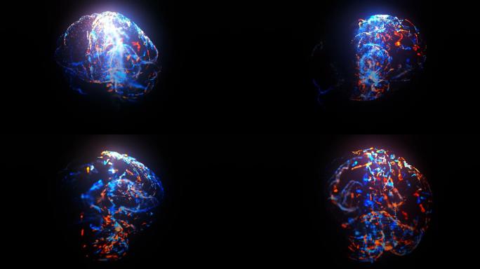 核磁共振成像扫描人脑