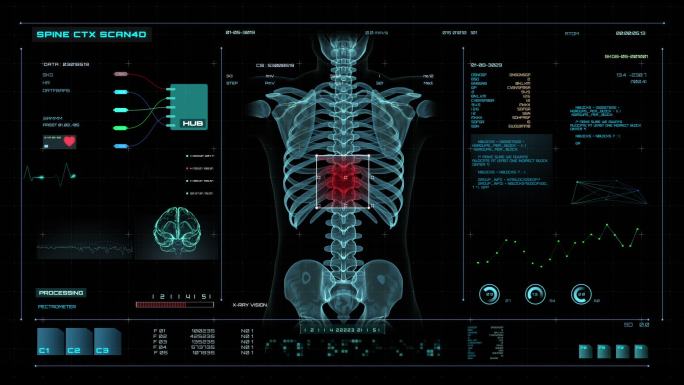 医学屏幕的脊椎扫描3D动画