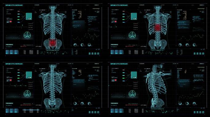 医学屏幕的脊椎扫描3D动画