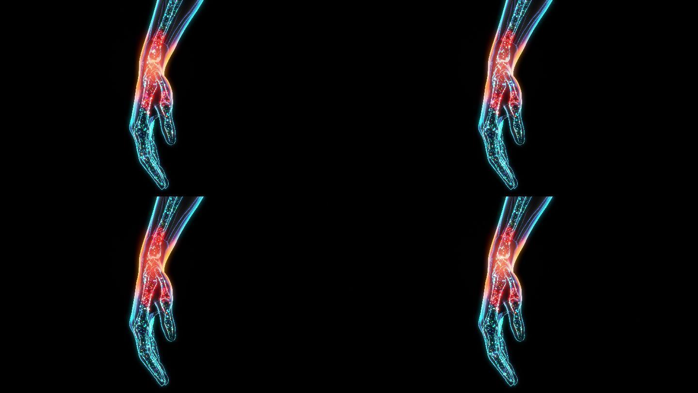 疼痛手腕的3d医学精确渲染动画