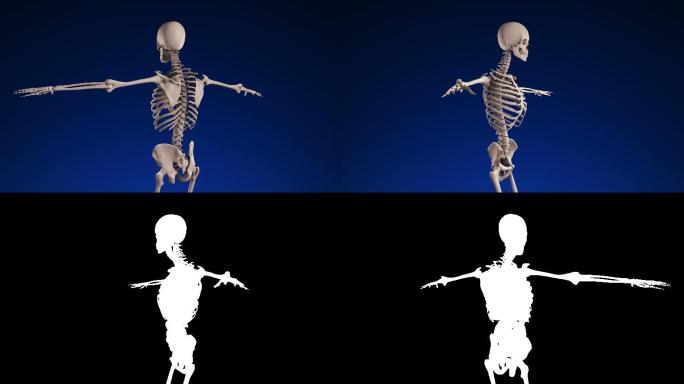 人类骨骼骨折引体模型