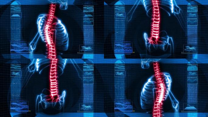 人体骨骼外科颈椎腰椎医疗医学