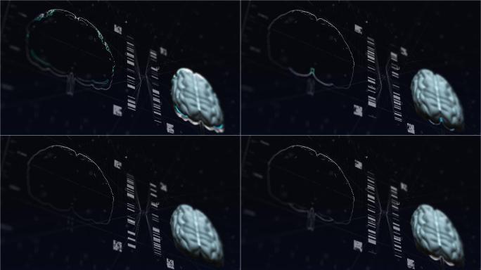 脑磁共振技术扫描特效合成元素全息hud素