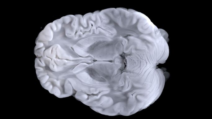 扫描仪扫描大脑扫描图像。