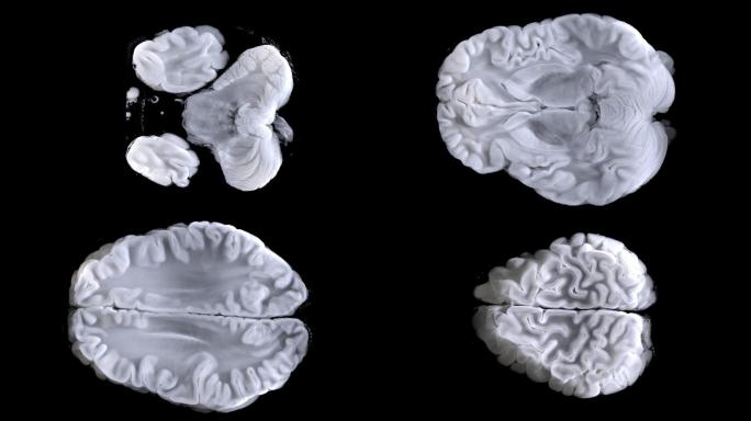 扫描仪扫描大脑扫描图像。