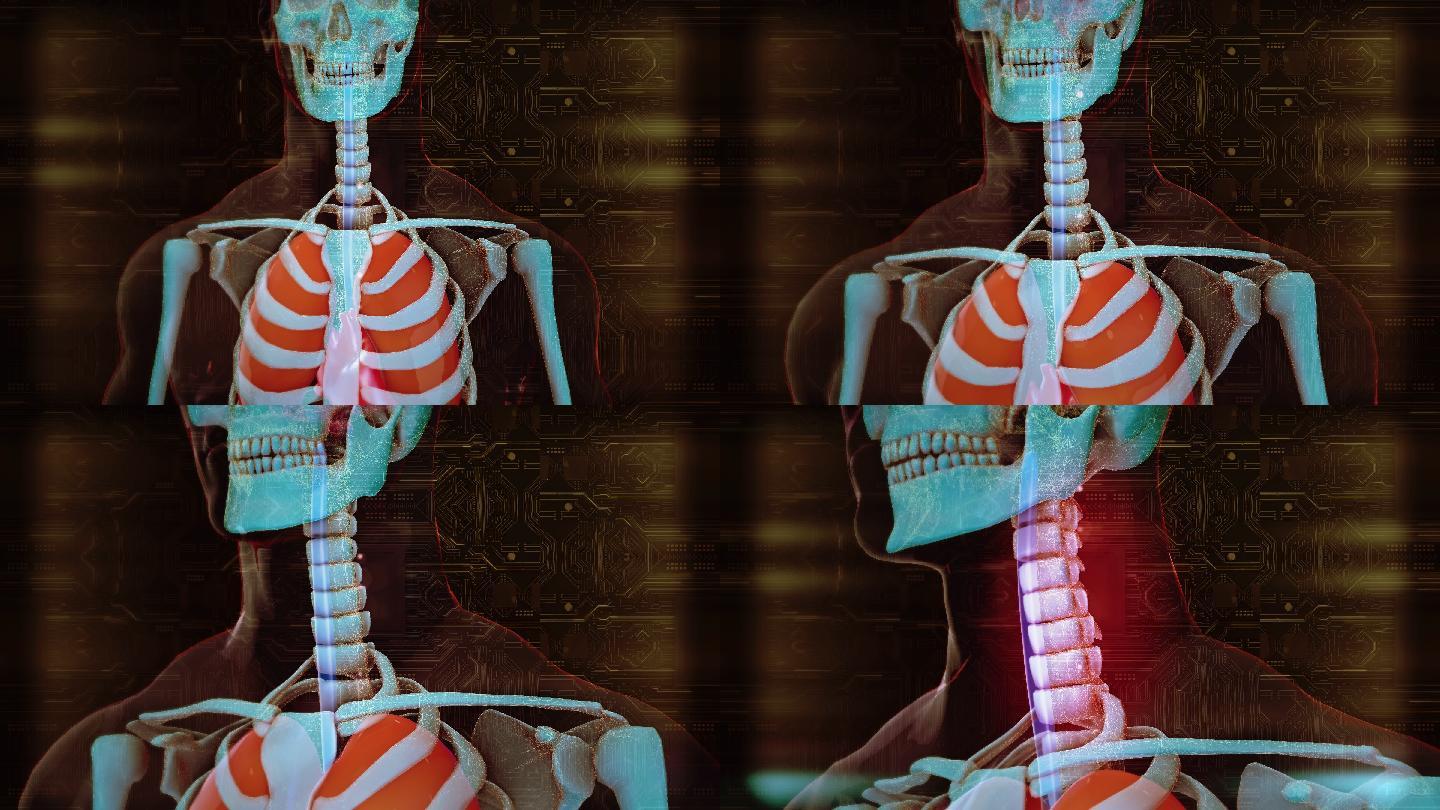 颈椎病动画脖子脊柱病变三维动画