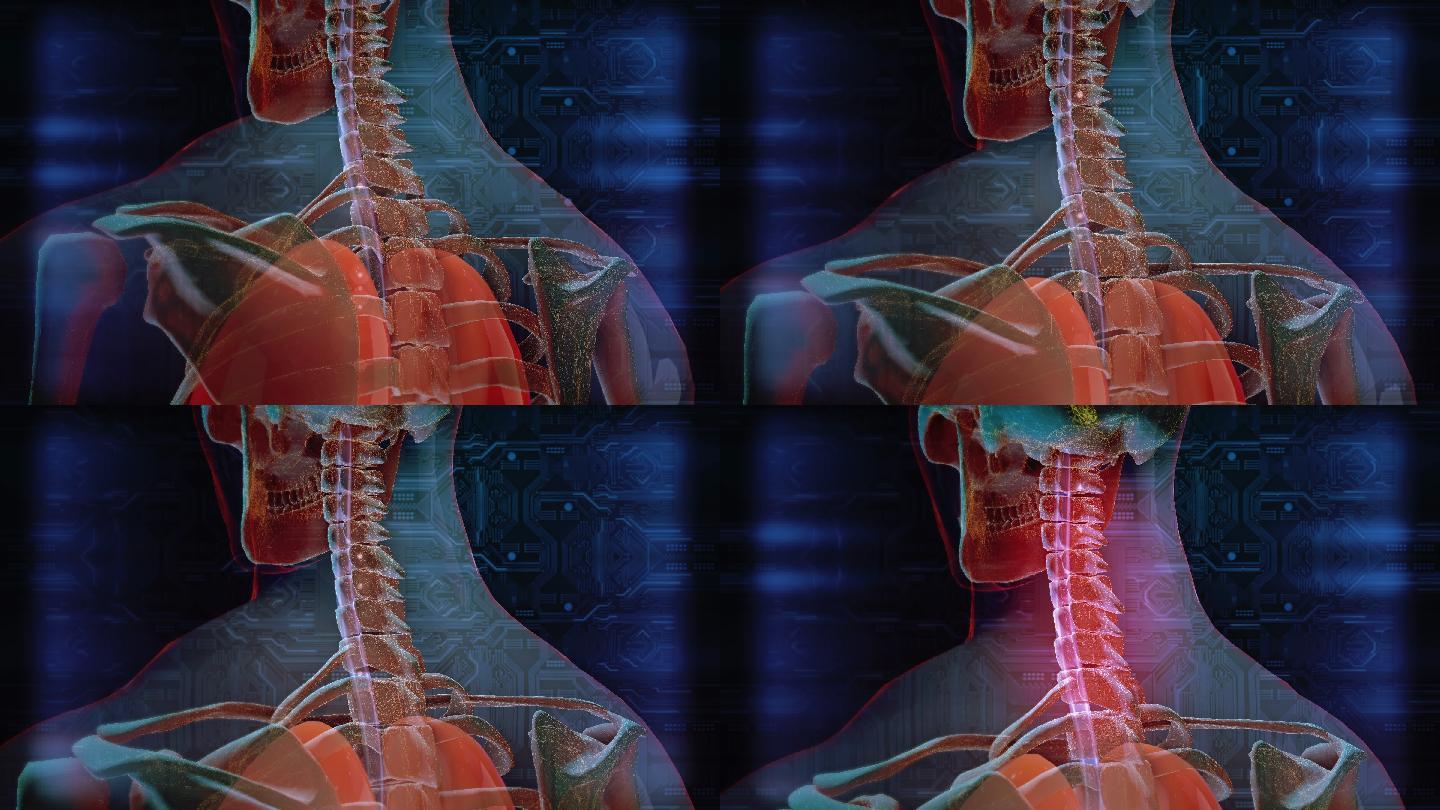 颈椎病三维3d模拟脊椎病痛演示