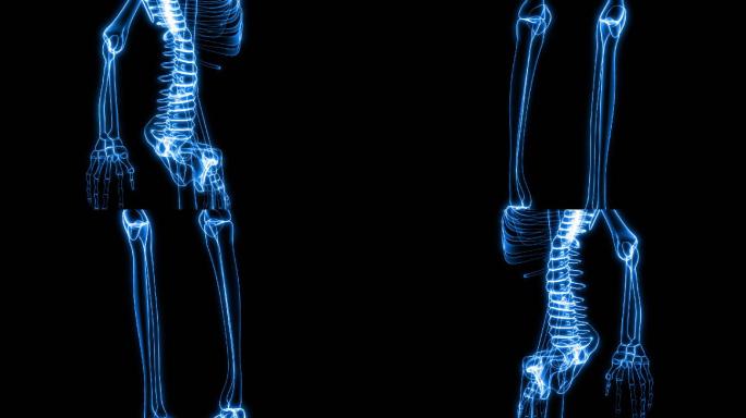 人体骨骼X射线特效视频3D简约