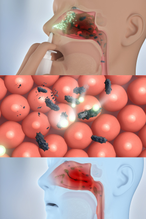 (含文件 )鼻炎修复杀灭病毒细菌 鼻腔