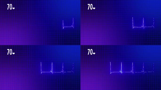 心电图心脏监护仪医疗医学科研背景心率