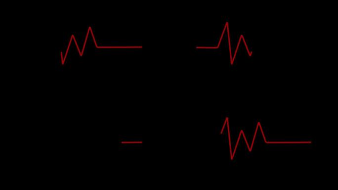 心电图动画。电波曲线折线