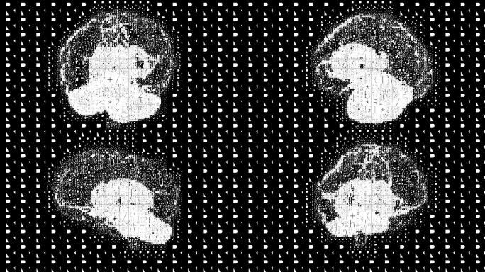 具有旋转像素化人脑的动画