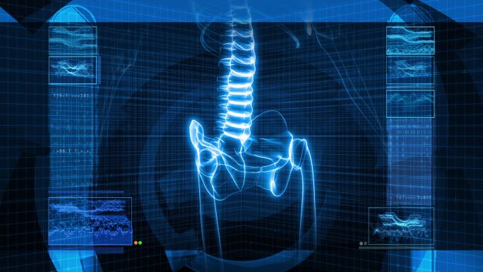 人体骨骼X射线CT体检透视图医院研究