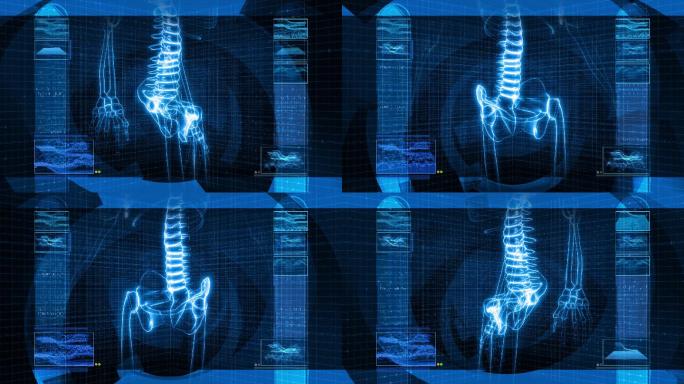 人体骨骼X射线CT体检透视图医院研究