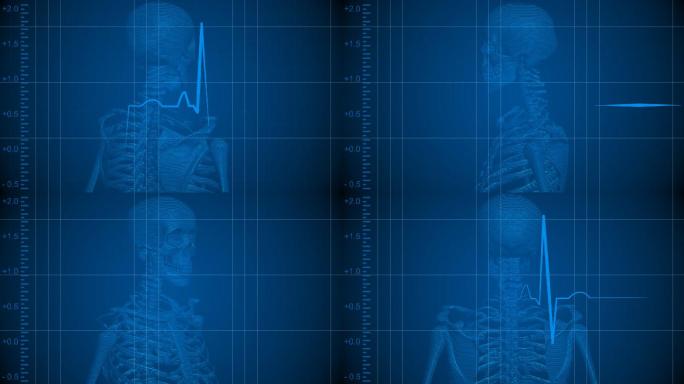 人体骨骼心电图医学检查扫描