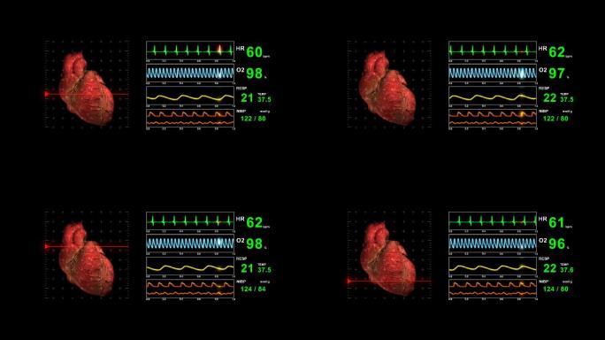 心电图显示急诊室重症监护室人体心脏
