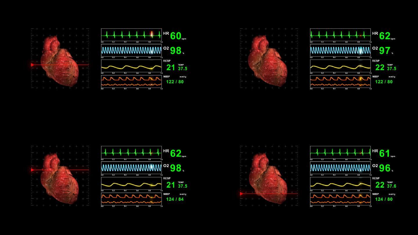 心电图显示急诊室重症监护室人体心脏