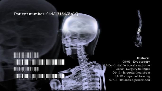 人体头部x射线的动画