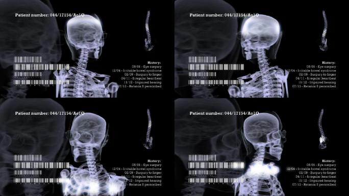 人体头部x射线的动画