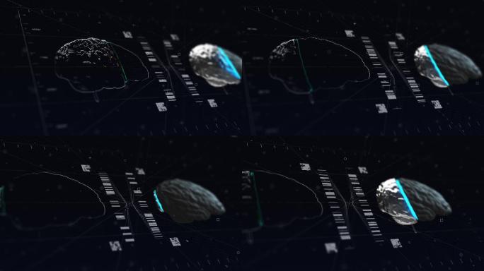 脑磁共振技术扫描特效视频抠像通道信息展示