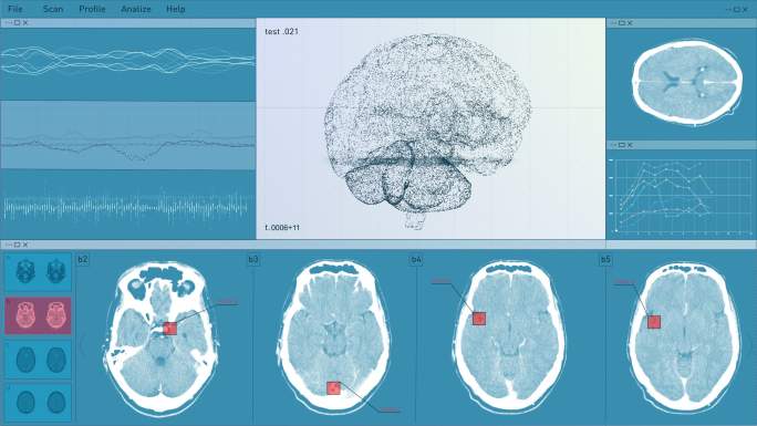 数字技术用户界面。脑部扫描